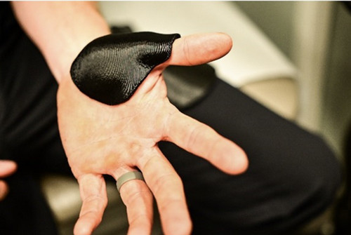 custom orthotic device being worn on a hand